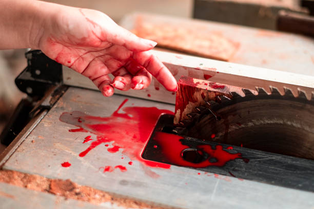 Hand and circular saw disc bloody on white background, Safety first